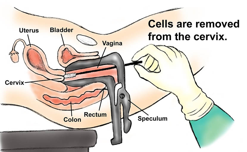 বয়সভেদে ১০ ধরনের পরীক্ষা-নিরীক্ষা কোনগুলো জানেন কী?