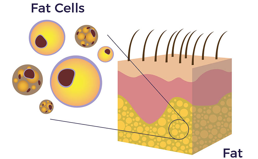 কমিয়ে ফেলুন পেটের মেদ ৫টি খাবারের সাহায্যে