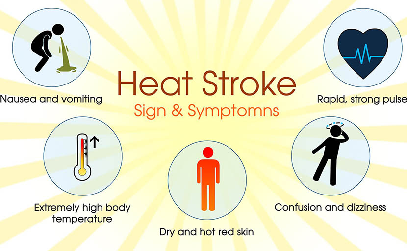 হিট স্ট্রোক | কারণ, লক্ষণ ও প্রতিকার সম্পর্কে কতটুকু জানেন?