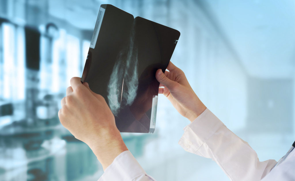 ব্রেস্ট ক্যান্সারের প্রাথমিক লক্ষণগুলো সম্পর্কে জানুন এবং সচেতন হোন