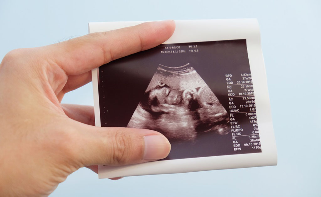 অ্যানোমালি স্ক্যান কী, কেন ও কখন করাবেন?